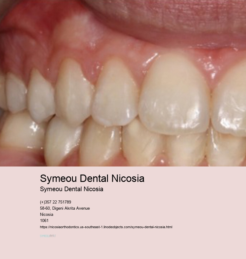 Symeou Dental Nicosia